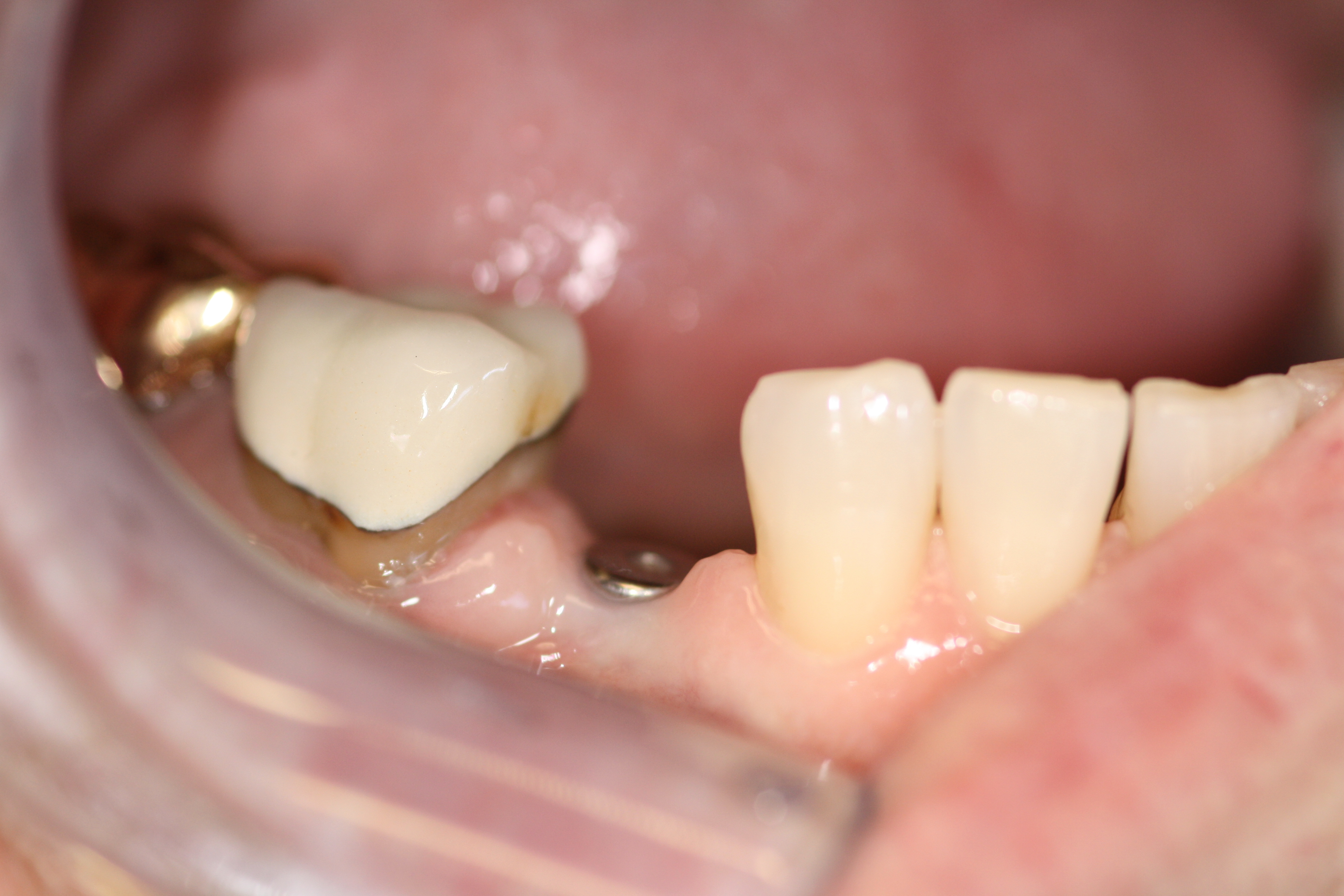 Smile Gallery Fair Oaks, CA Dr. Brian Orcutt